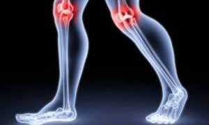 Воспаление коленного сустава как лечить
