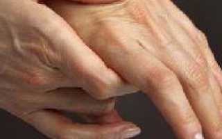 Боль в суставах пальцев рук причины