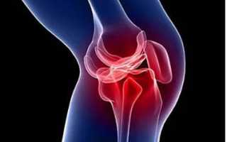 Почему болит с внутренней стороны колена при разгибании